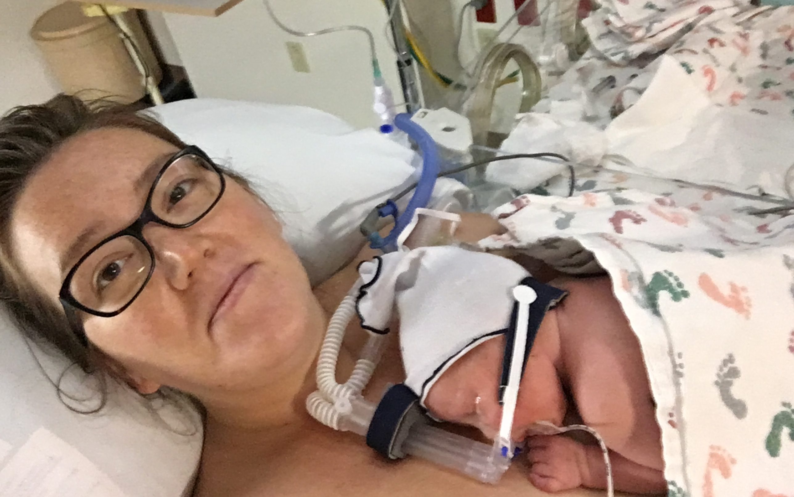 Image shows young white woman with messy hair and glasses lying in a hospital bed smiling. On her chest in a premature baby sleeping comfortably with breathing equipment on his face. They are both wrapped in a blanket. 